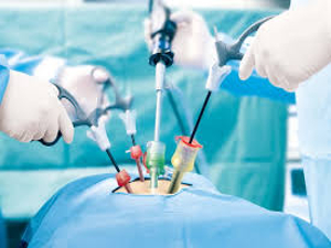 General & Laparoscopy Surgery KNOW MORE